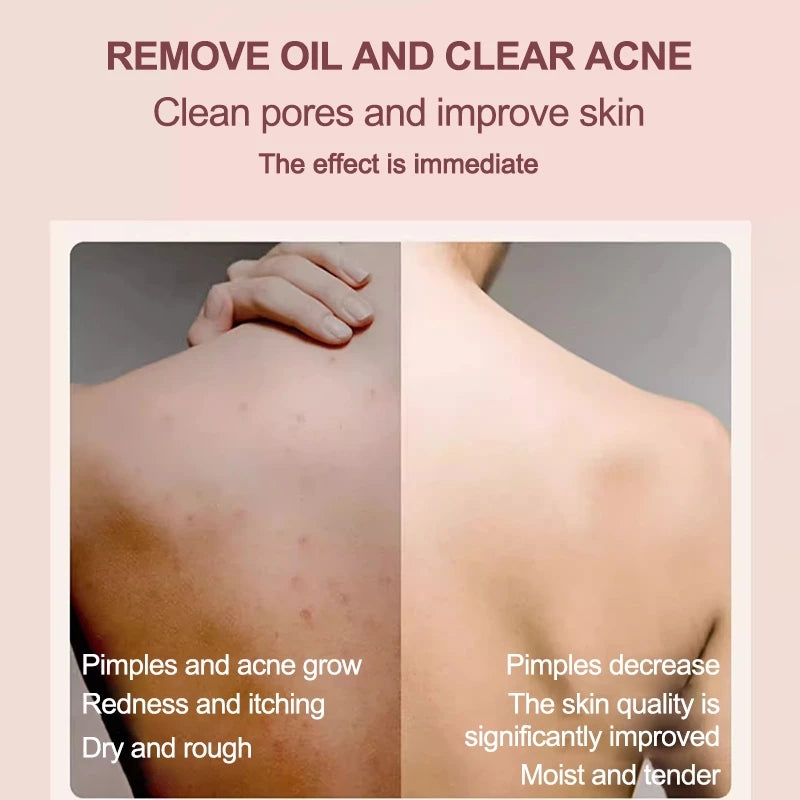 Silicone Shower Scrub (Double Sided)